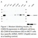 CDKN1B Polyclonal Antibody (20 μl)