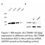 CTNNB1 Polyclonal Antibody (20 μl)