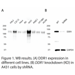 DDR1 Polyclonal Antibody (20 μl)