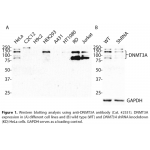 DNMT3A Polyclonal Antibody (20 μl)
