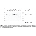 EEF2K Polyclonal Antibody (20 μl)