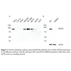 EEF2K Polyclonal Antibody (20 μl)