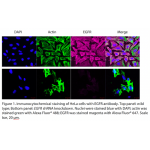 EGFR Polyclonal Antibody (20 μl)