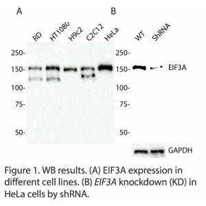 EIF3A Polyclonal Antibody (20 μl)