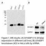 EIF4EBP1 Polyclonal Antibody (20 μl)
