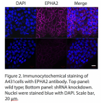 EPHA2 Polyclonal Antibody (20 μl)