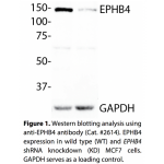 EPHB4 Polyclonal Antibody (20 μl) 