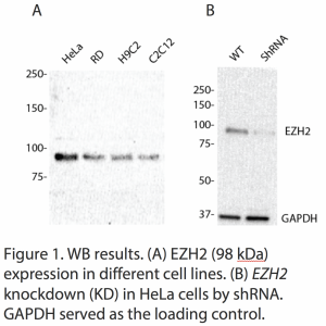 EZH2 Polyclonal Antibody (20 μl)
