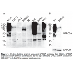 GPRC5A Polyclonal Antibody (20 μl)