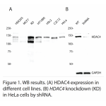 HDAC4 Polyclonal Antibody (20 μl)