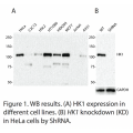 HK1 Polyclonal Antibody (20 μl)
