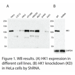 HK1 Polyclonal Antibody (20 μl)