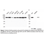 HK1 Monoclonal Antibody (20 μl) 