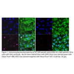 JAK2 Polyclonal Antibody (20 μl)  