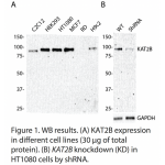 KAT2B Polyclonal Antibody (20 μl)  