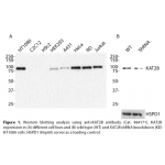 KAT2B Monoclonal Antibody (20 μl) 