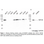 KMT2B Polyclonal Antibody (20 μl)  