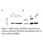 MSH2 Polyclonal Antibody (20 μl)  
