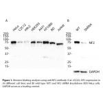 NF2 Polyclonal Antibody (20 μl)  