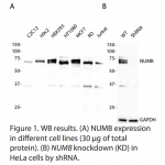 NUMB Polyclonal Antibody (20 μl)  