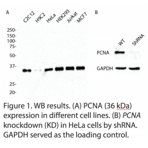 PCNA Polyclonal Antibody (20 μl)  