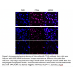 PCNA Polyclonal Antibody (20 μl)  