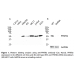 PFKFB2 Polyclonal Antibody (20 μl)  
