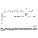 PFKP Polyclonal Antibody (20 μl)  