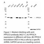 PPP2CA Polyclonal Antibody (20 μl)  