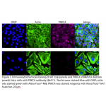 PRKCA Polyclonal Antibody (20 μl)  