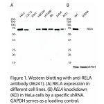 RELA Polyclonal Antibody (20 μl)  