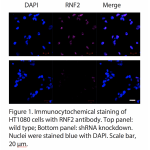 RNF2 Polyclonal Antibody (20 μl)  
