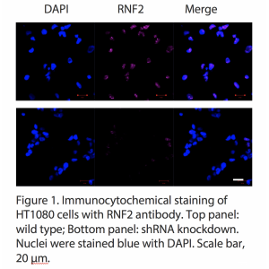 RNF2 Polyclonal Antibody (20 μl)  