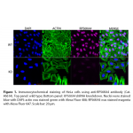 RPS6KA4 Polyclonal Antibody (20 μl)  