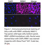 RRM1 Polyclonal Antibody (20 μl)  