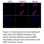 SMAD2 Polyclonal Antibody (20 μl)  