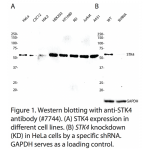 STK4 Polyclonal Antibody (20 μl)  