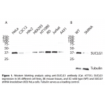 SUCLG1 Polyclonal Antibody (20 μl)  
