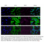 TNFRSF1B Polyclonal Antibody (20 μl)  