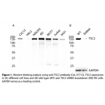 TSC2 Polyclonal Antibody (20 μl)  