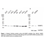 VAMP2 Polyclonal Antibody (20 μl)  