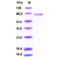 ALPL Protein (His Tag), Human (20 µg)
