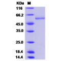 ENTPD1 Protein (His Tag),Human 