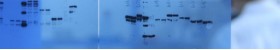 SuperECL™ Western Blotting Detection Kits