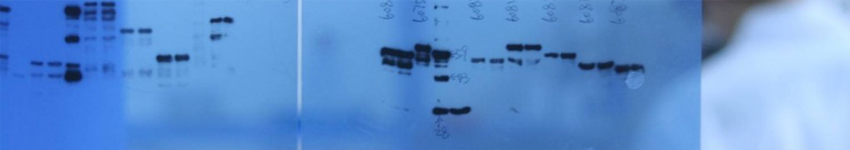 SuperECL™ Western Blotting Detection Kits