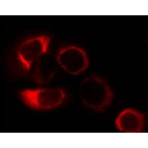 CMTMRos (1 ml)