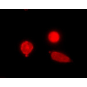 Ethidium Homodimer-1 (1 mg)