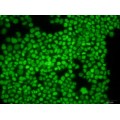 Green Dead-cell Nucleic Acid Stain (1 ml)
