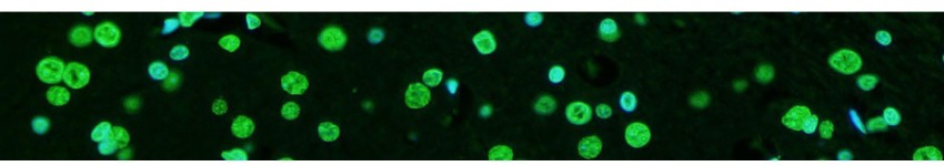 TUNEL Apoptosis Detection Kits