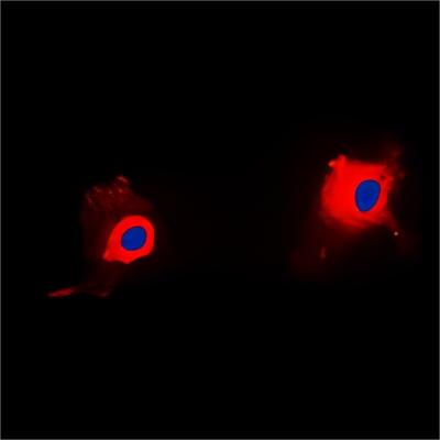 TP53I11 polyclonal antibody